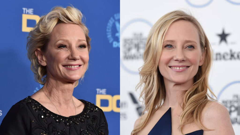 Anne Heche Unfall: Hergang, Todesursache und Biografie der Schauspielerin Anne Heche Unfall